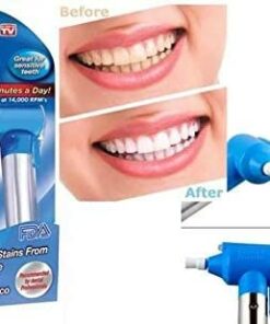 Alternative view of اداة تبييض الاسنان smile