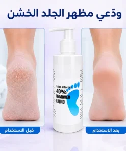 مجموعة العناية الشخصية "" تنظيف البشرة & برد الاظافر & إزالة الجلد الميت 19 مجموعة العناية الشخصية "" تنظيف البشرة & برد الاظافر & إزالة الجلد الميت - الصورة 6